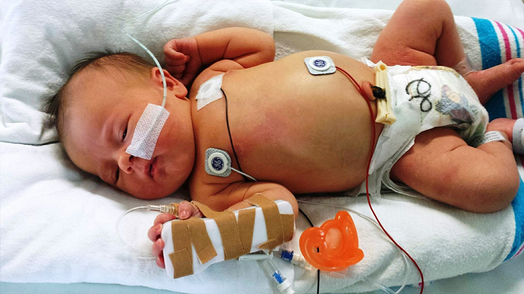 Enfermedades en el primer año de vida de un bebé