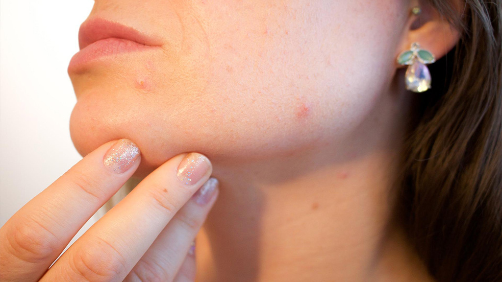 Cómo podemos prevenir las infecciones