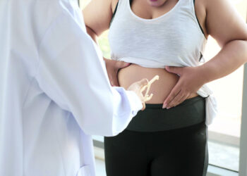 Cómo saber si tienes obesidad o sobrepeso